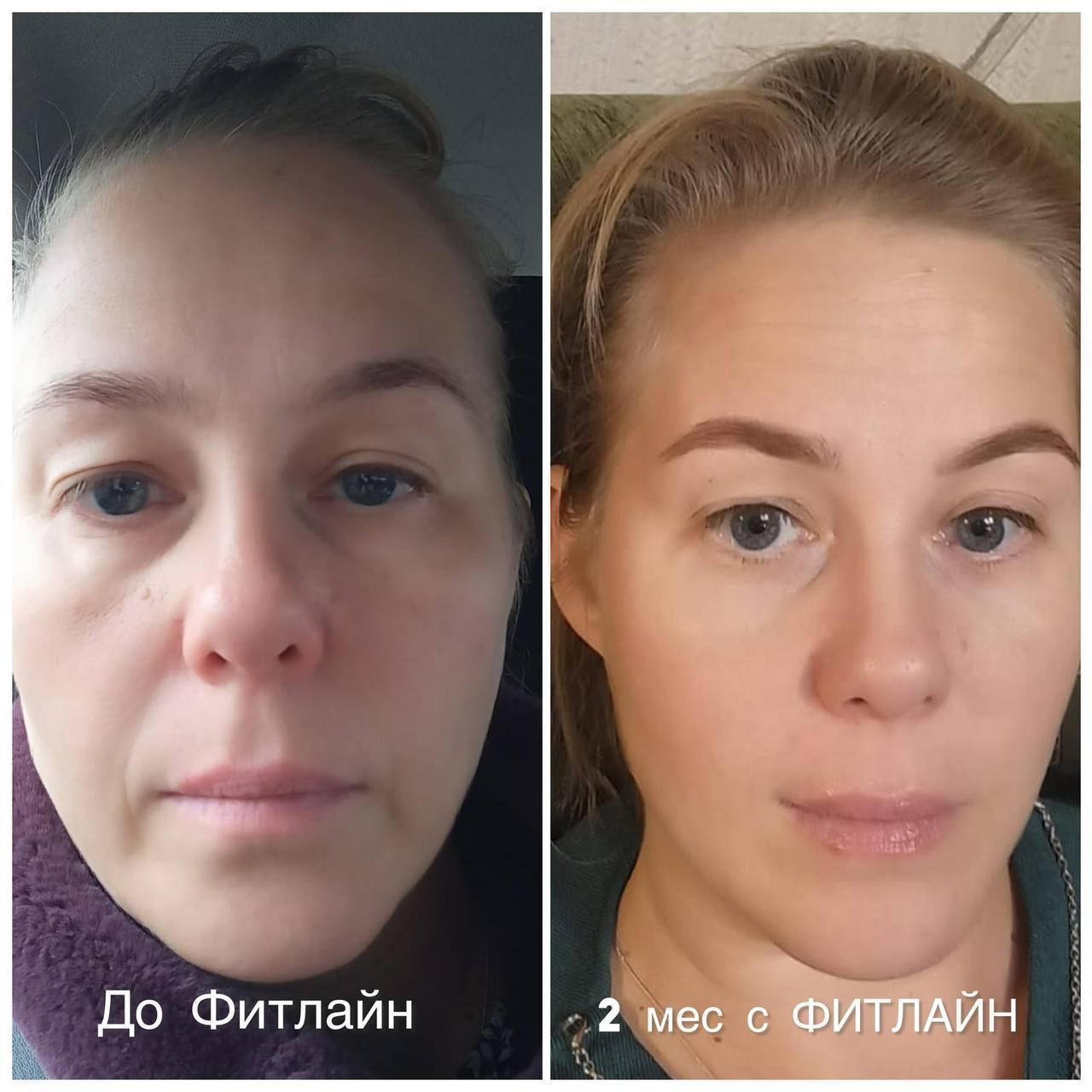 До FitLine — 2 месяца с FitLine кожа