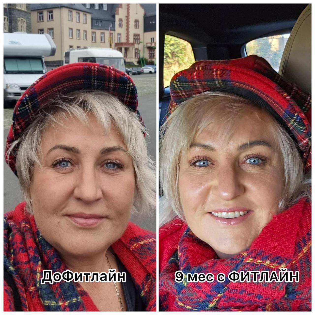 До и после FitLine кожа лица 9 месяцев 50+
