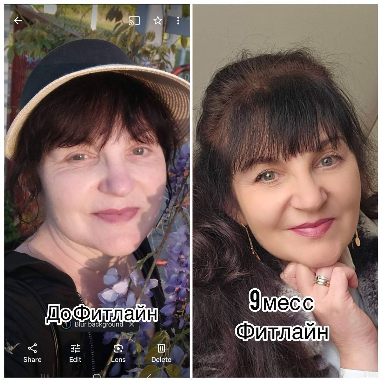 До и после FitLine кожа женщина 50+ 9 месяцев