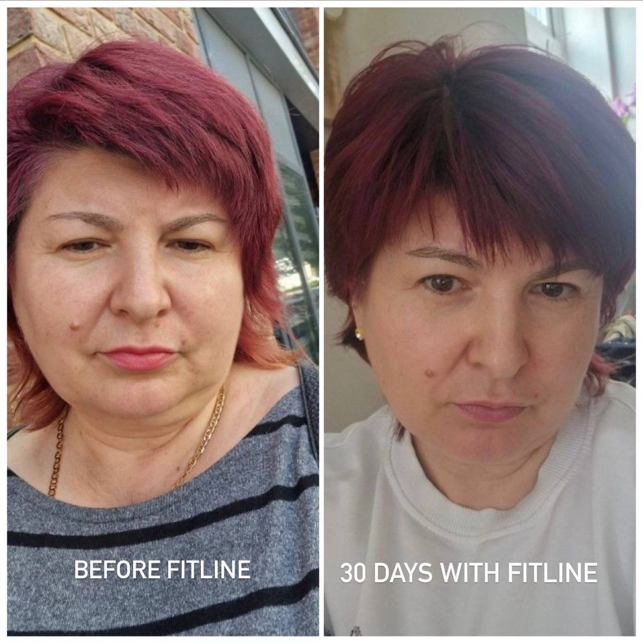 Before Fitline 30 days with Fitline 50+
