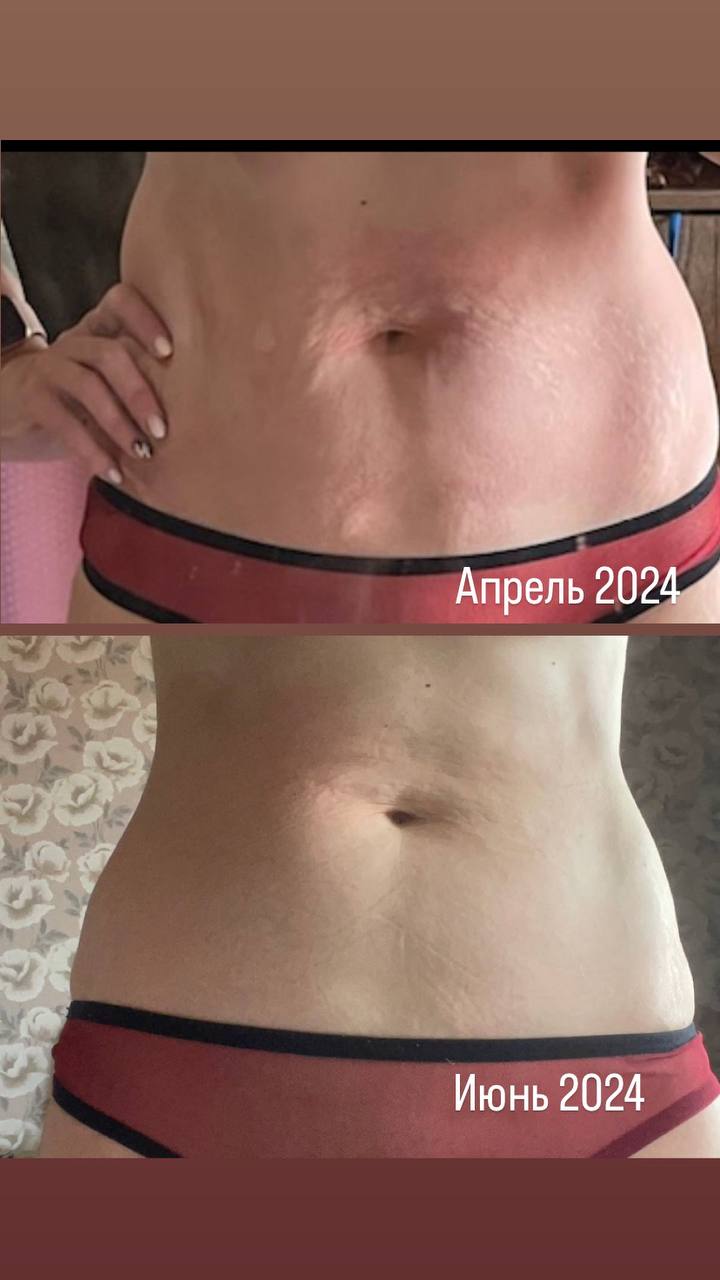 До и после FitLine живот апрель июнь 2024