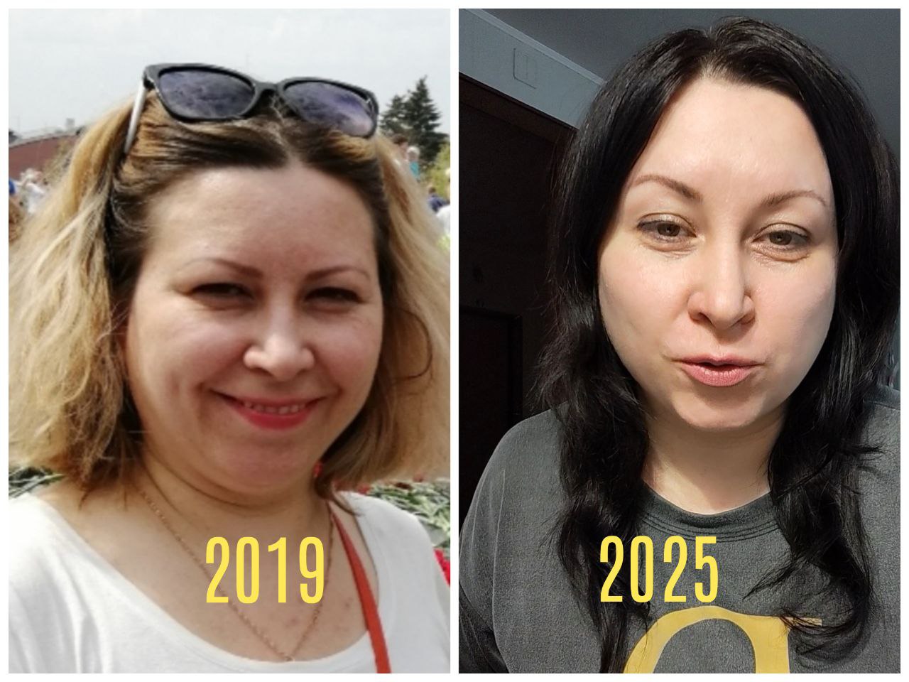 До и после FitLine лицо 2019 2025