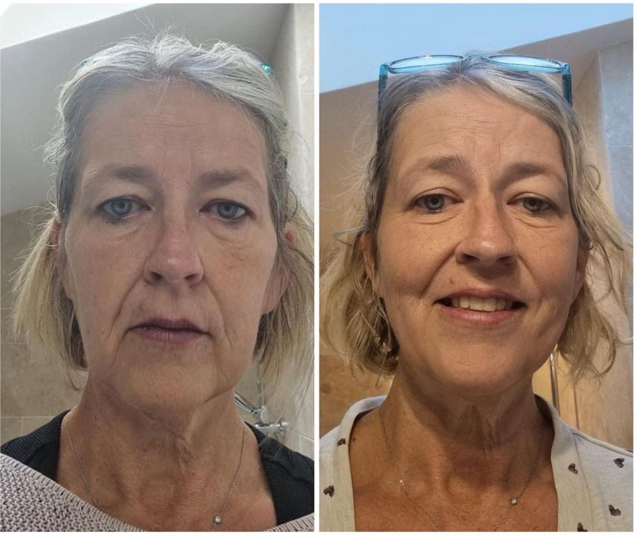 Женщина 60+ FitLine до и после кожа серые волосы