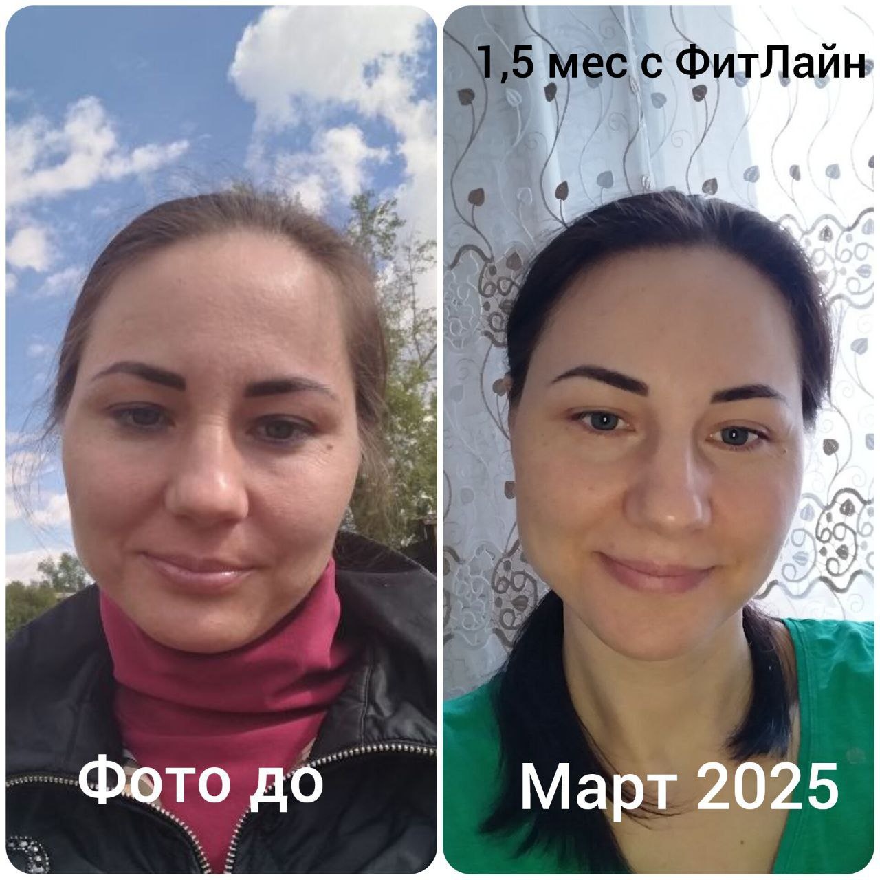 До и после FitLine 1.5 месяца кожа лица март 2025