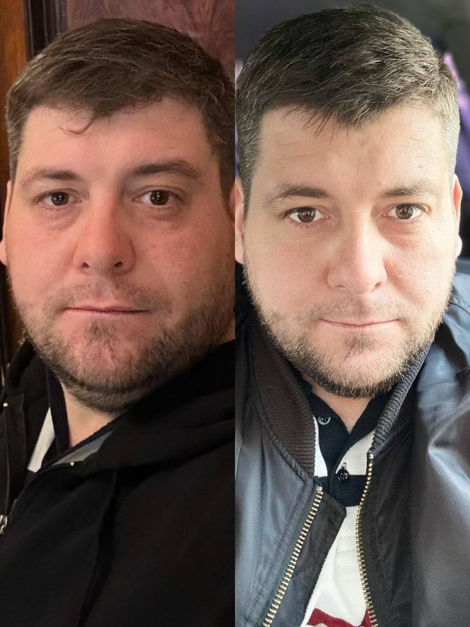 Мужчина до и после FitLine лицо похудел