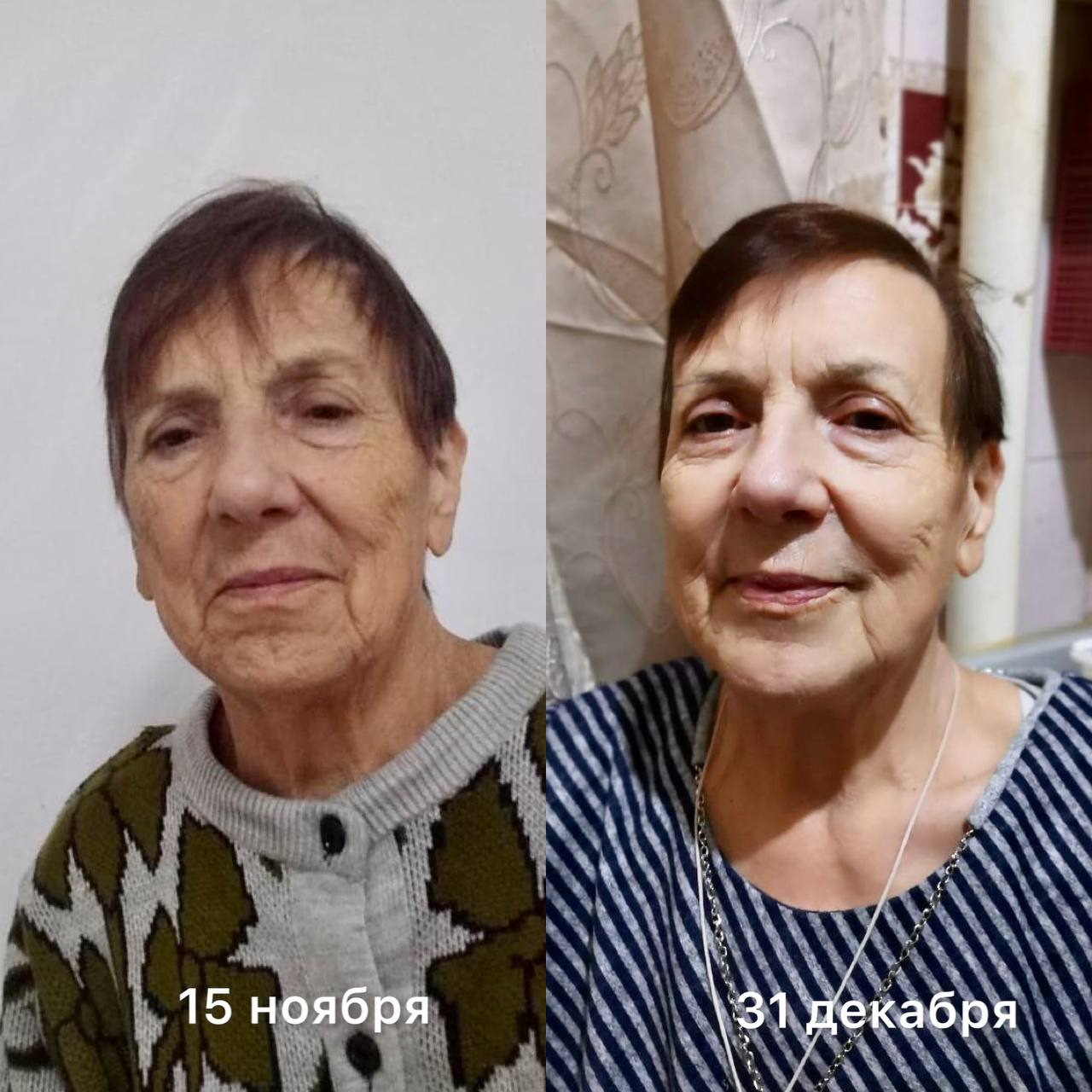 FitLine до и после пожилая женщина ноябрь декабрь