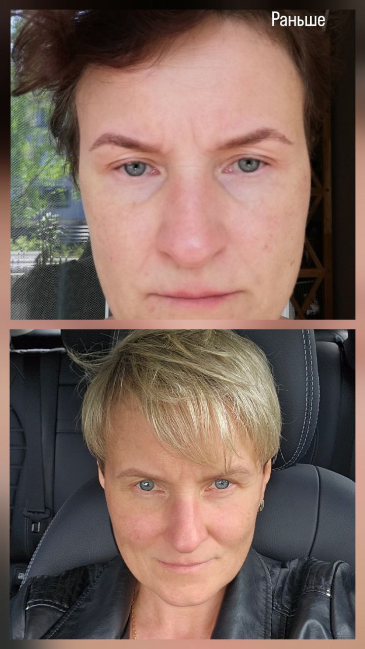 FitLine раньше и сейчас кожа лица волосы