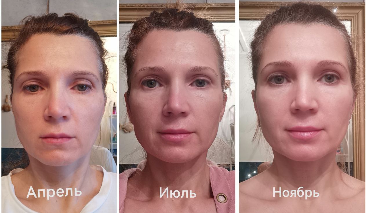FitLine кожа три этапа апрель июль ноябрь