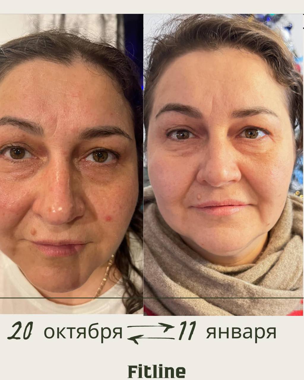 До и после FitLine кожа лица 50+ октябрь январь