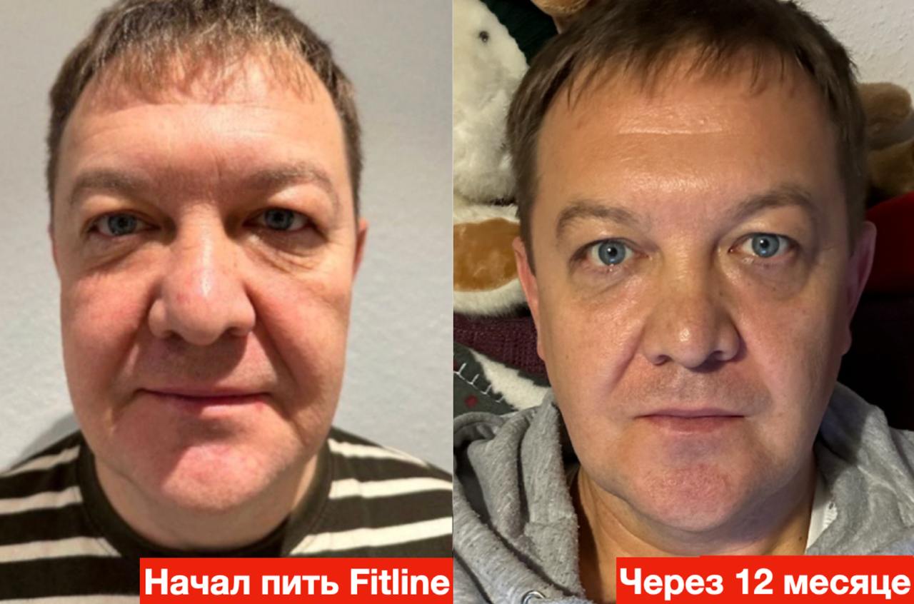 Мужчина до и после FitLine 12 месяцев кожа лицо