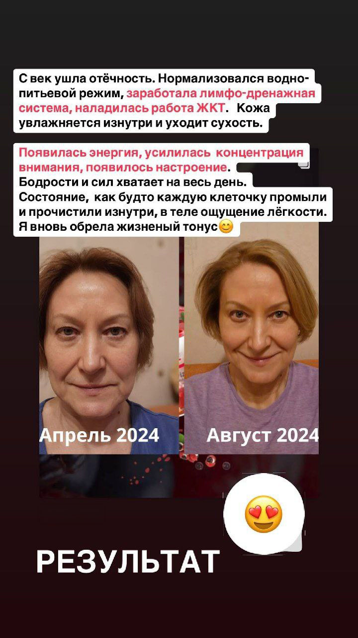 FitLine результат кожа энергия апрель август 2024
