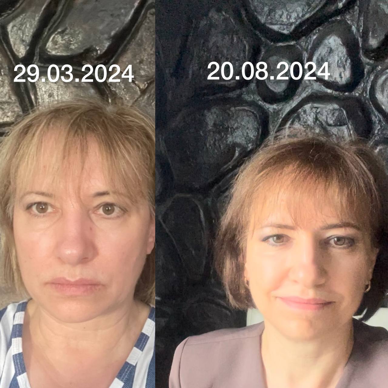 До и после FitLine март-август 2024