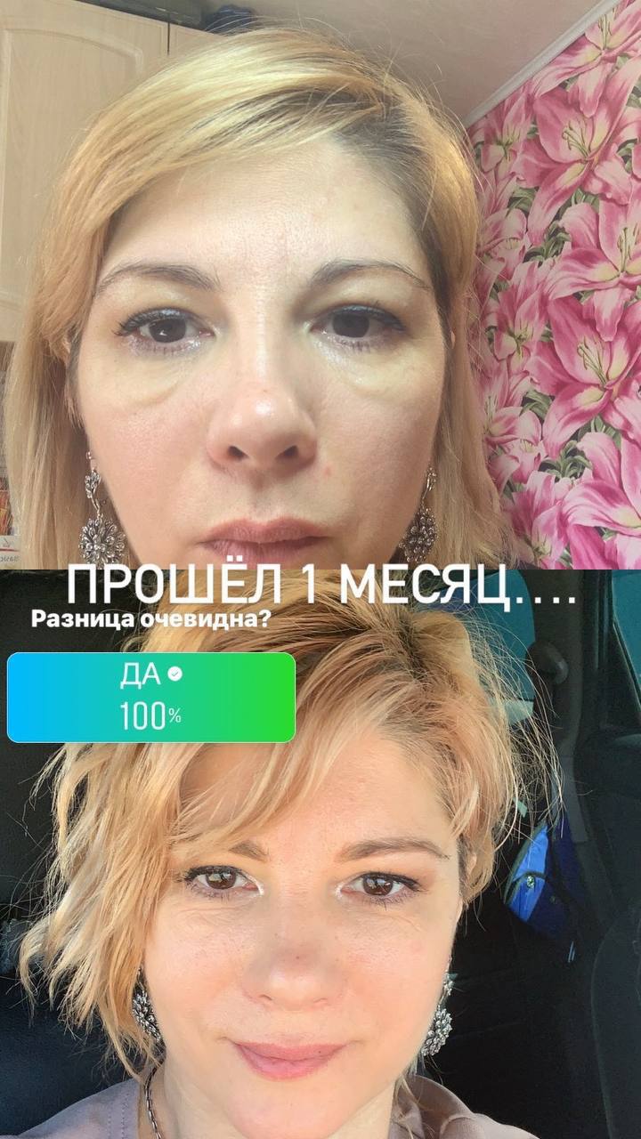 FitLine прошёл месяц разница очевидна кожа